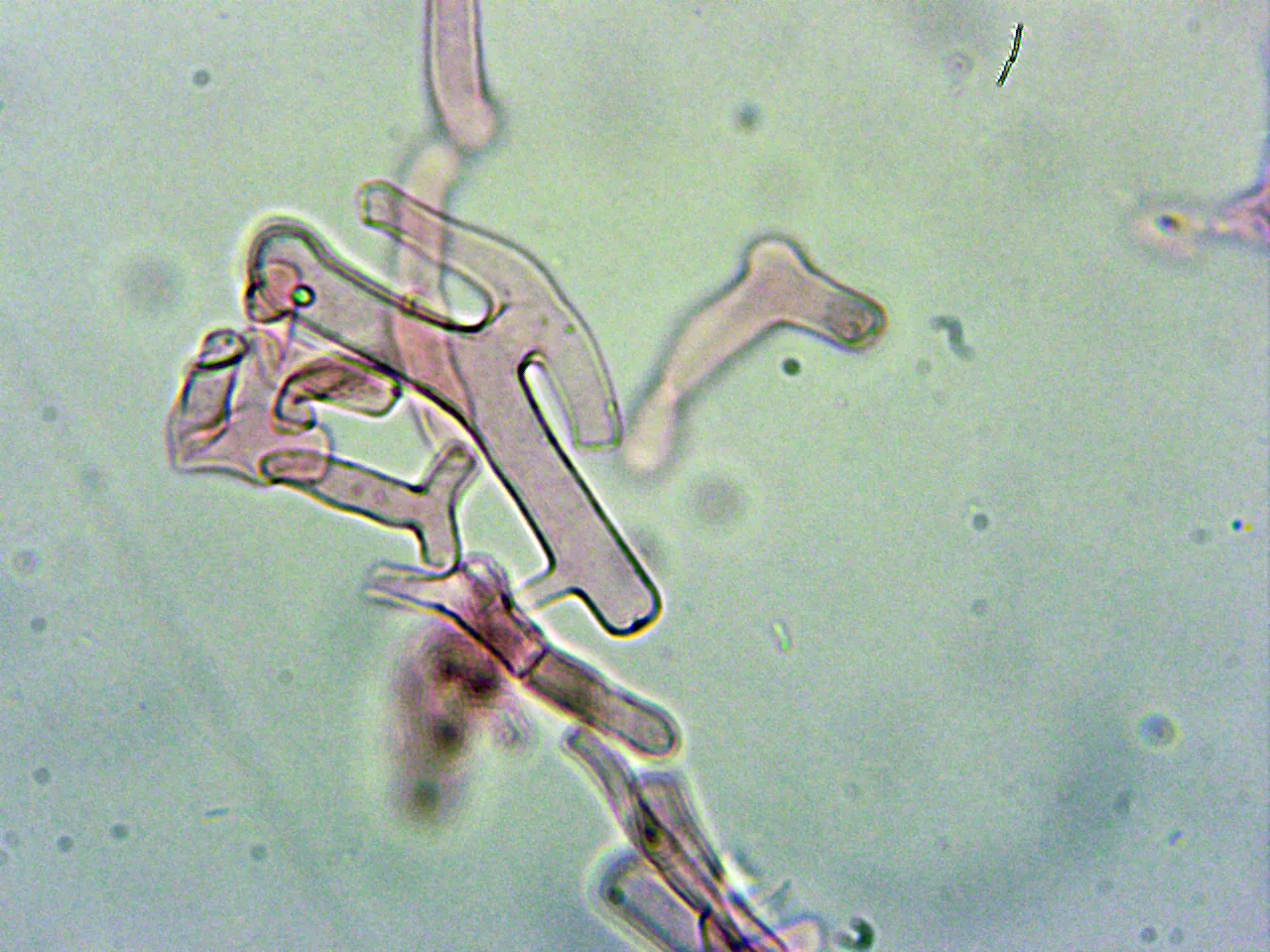 Microscopía de Leucocoprinus cretaceus - 10 - Hifas velo pileo 3